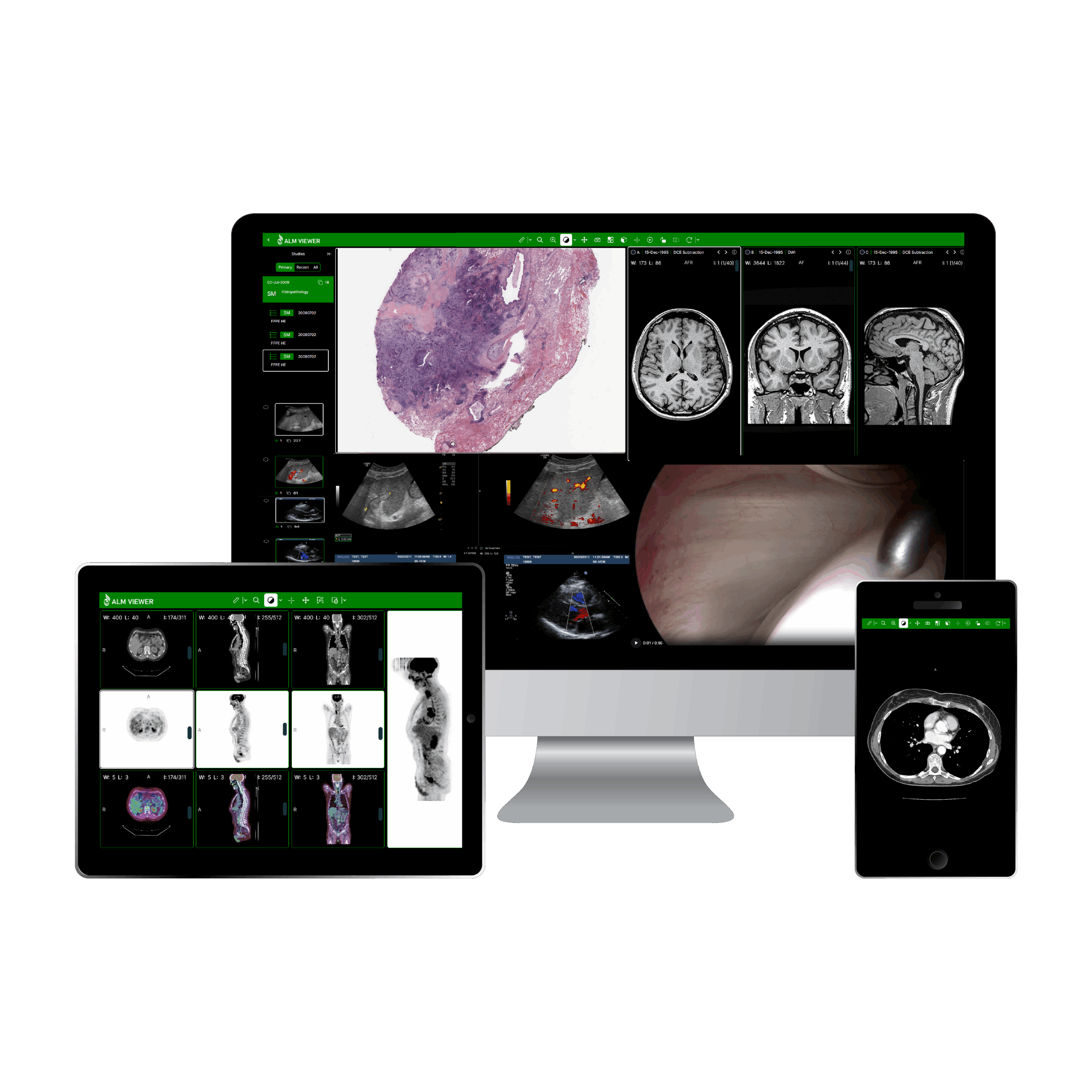 ALM DICOM Viewer